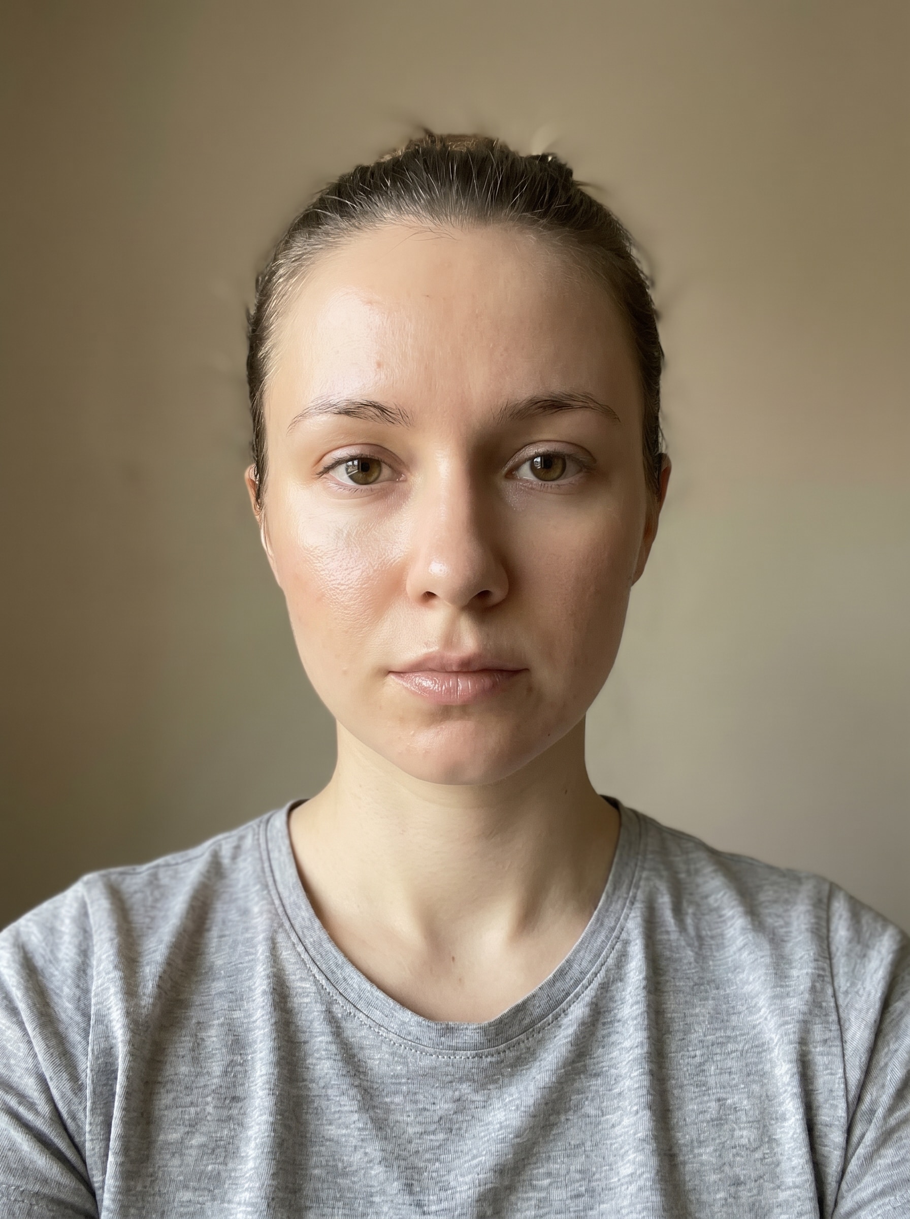 Glass Skin Filter After