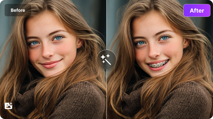 ai braces filter online